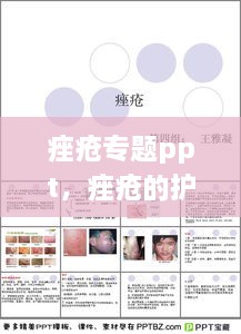 痤疮专题ppt，痤疮的护理ppt 